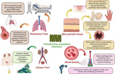 Antimicrobial resistance of Pseudomonas aeruginosa: navigating clinical impacts, current resistance trends, and innovations in breaking therapies